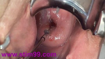 Play Cervix Fucking Play Deep Japanese Asian - å­å®®é ¸éƒ¨ã‚¯ã‚½