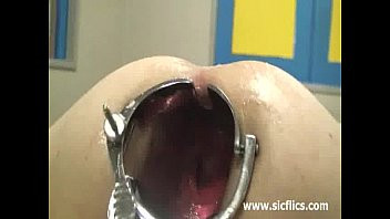 Play Shocking anal speculum gaping and fisting