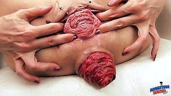 Play EXTREME PROLAPSE Pumping and Destroyed Pussy MILF Sasha from ArgentinaNaked